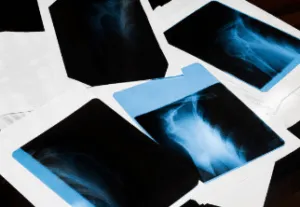 Radiografie mediche sparse su una scrivania